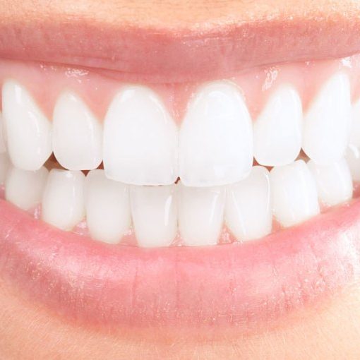 Periodontics in Turkey