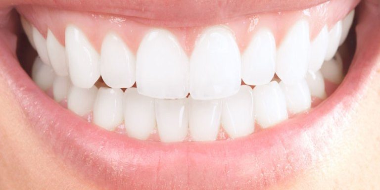 Periodontics in Turkey