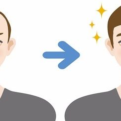 Hair Restoration in Turkey hair transplantation turkey