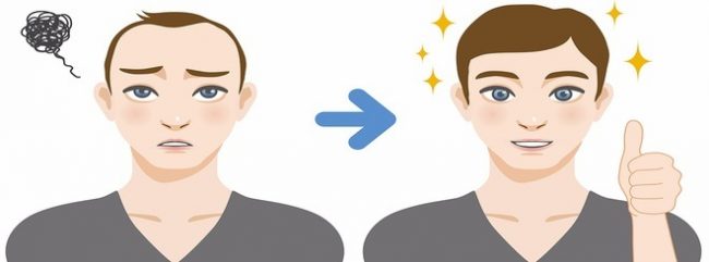 hair transplantation turkey