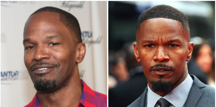 jamie foxx hair transplant before and after