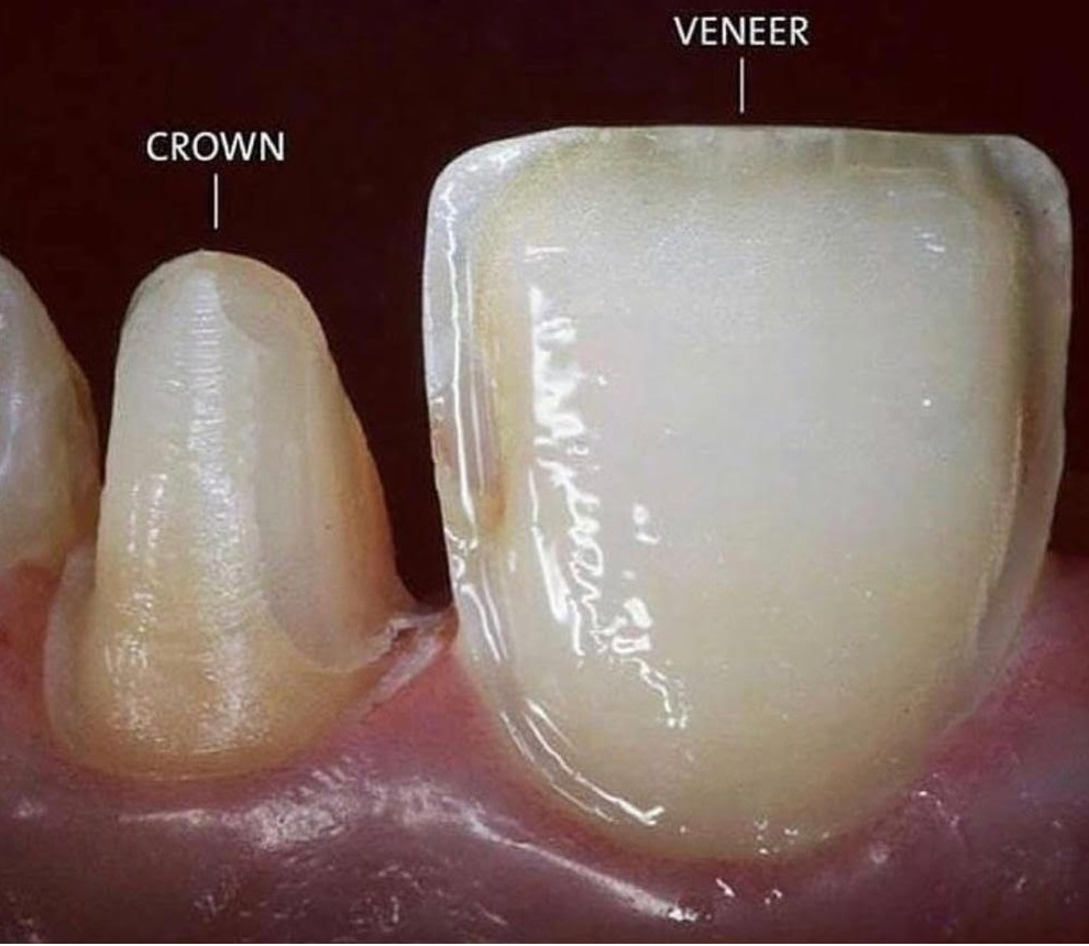 dental tourism in turkey