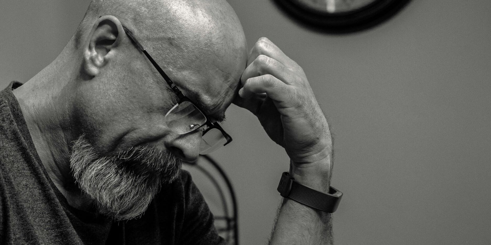 Hair Transplant Turkey vs USA